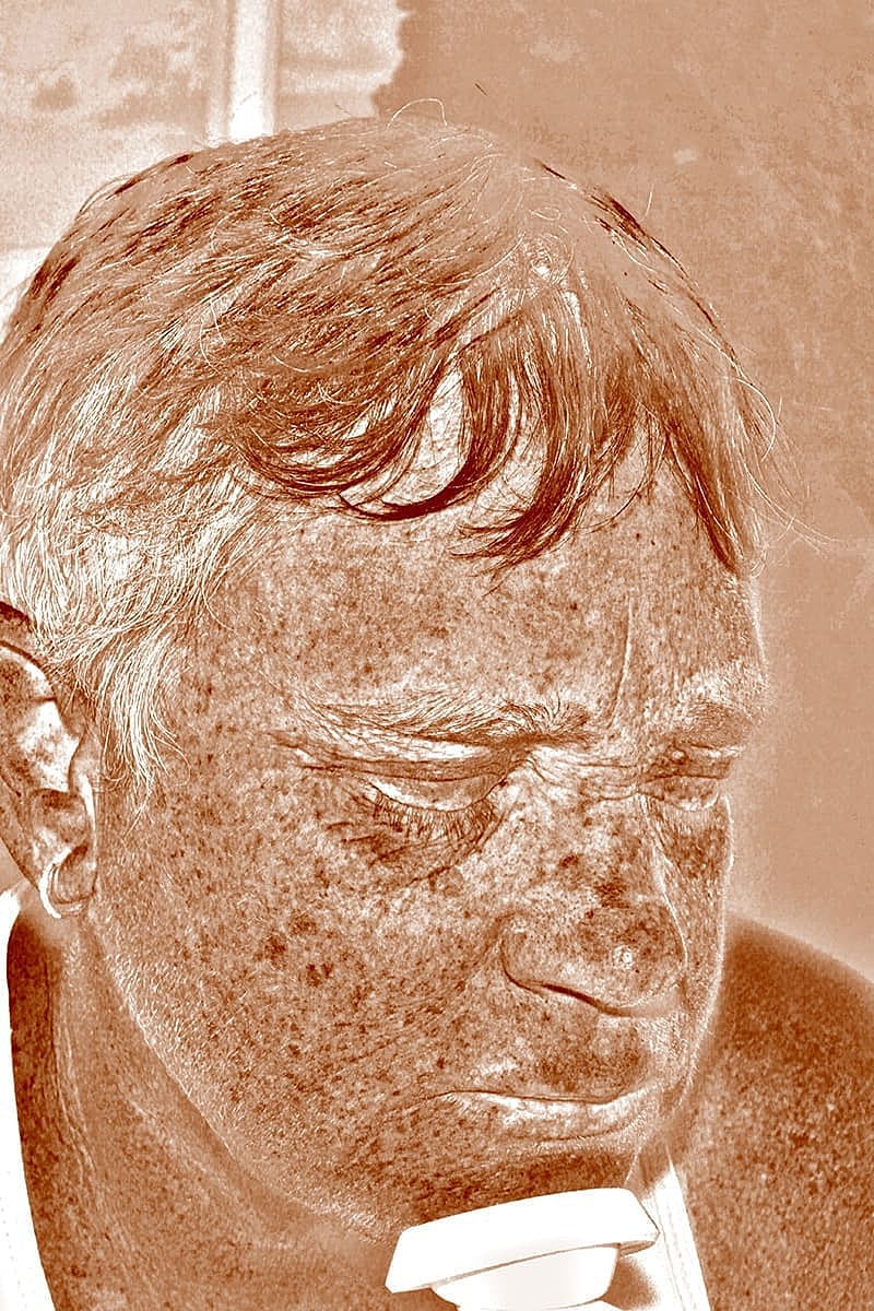 Halo Hybrid Fractional Laser Before & After