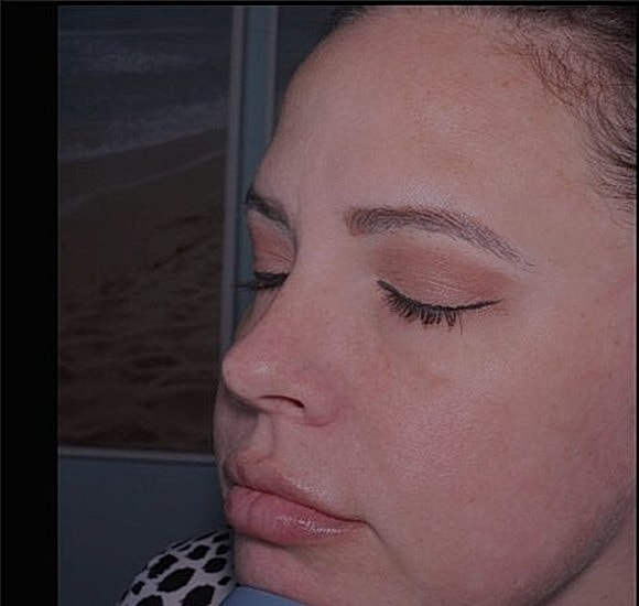 BBL Hero Before & After